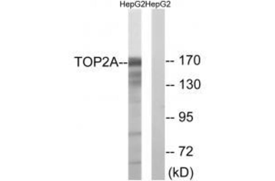 Western blot - TOP2A (Ab-1343) Antibody from Signalway Antibody (33258) - Antibodies.com