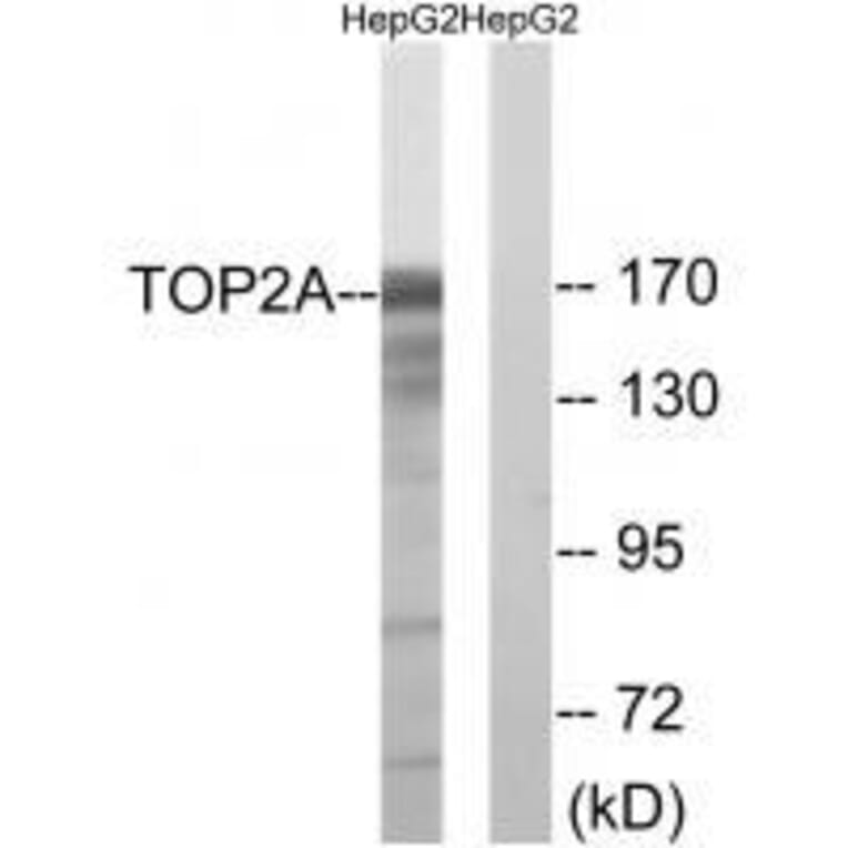 Western blot - TOP2A (Ab-1343) Antibody from Signalway Antibody (33258) - Antibodies.com