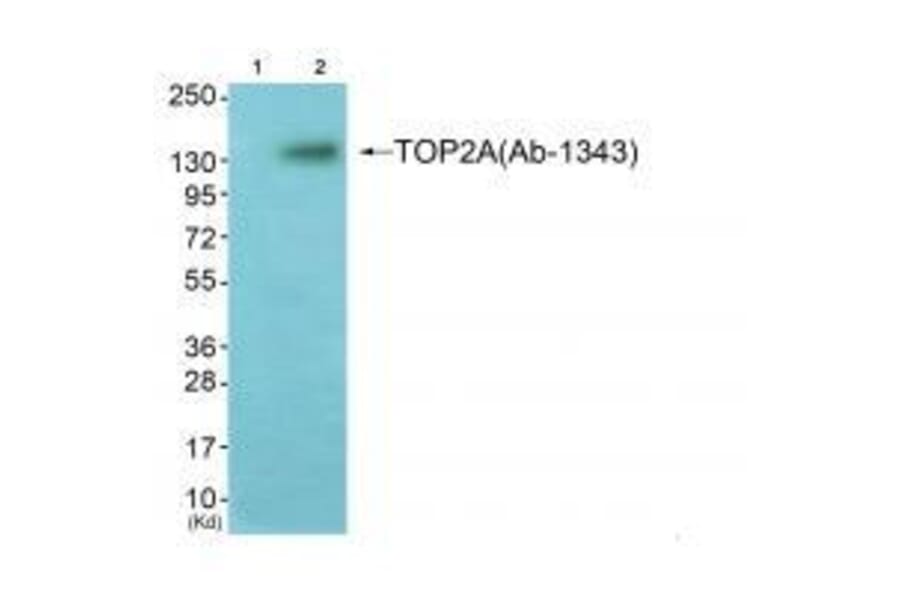 Western blot - TOP2A (Ab-1343) Antibody from Signalway Antibody (33258) - Antibodies.com