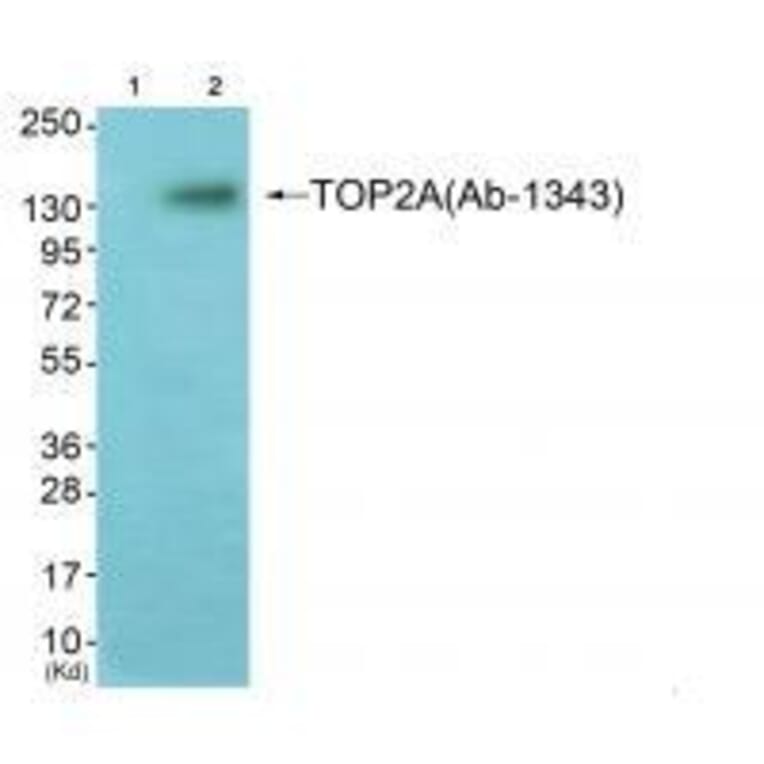 Western blot - TOP2A (Ab-1343) Antibody from Signalway Antibody (33258) - Antibodies.com