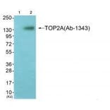 Western blot - TOP2A (Ab-1343) Antibody from Signalway Antibody (33258) - Antibodies.com