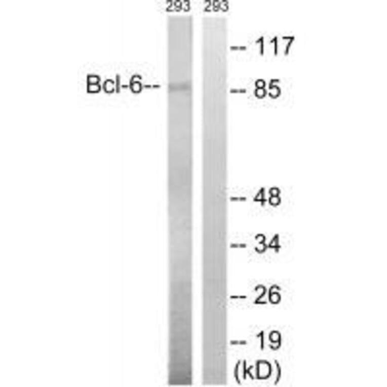 Western blot - Bcl-6 (Ab-333) Antibody from Signalway Antibody (33276) - Antibodies.com