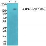 Western blot - GRIN2B (Ab-1303) Antibody from Signalway Antibody (33300) - Antibodies.com