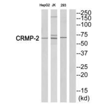 Western blot - CRMP-2 (Ab-522) Antibody from Signalway Antibody (33317) - Antibodies.com