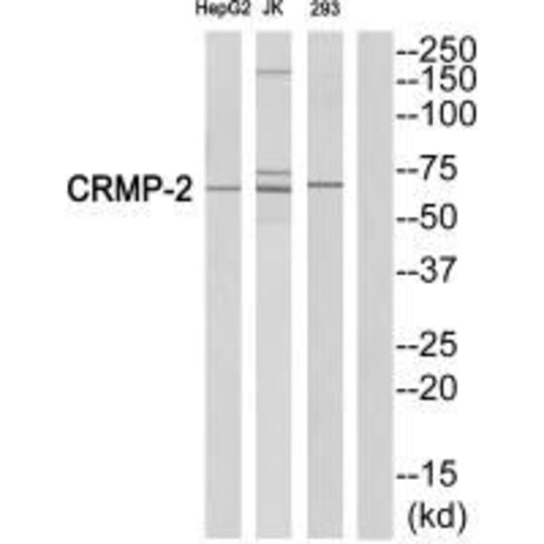 Western blot - CRMP-2 (Ab-522) Antibody from Signalway Antibody (33317) - Antibodies.com