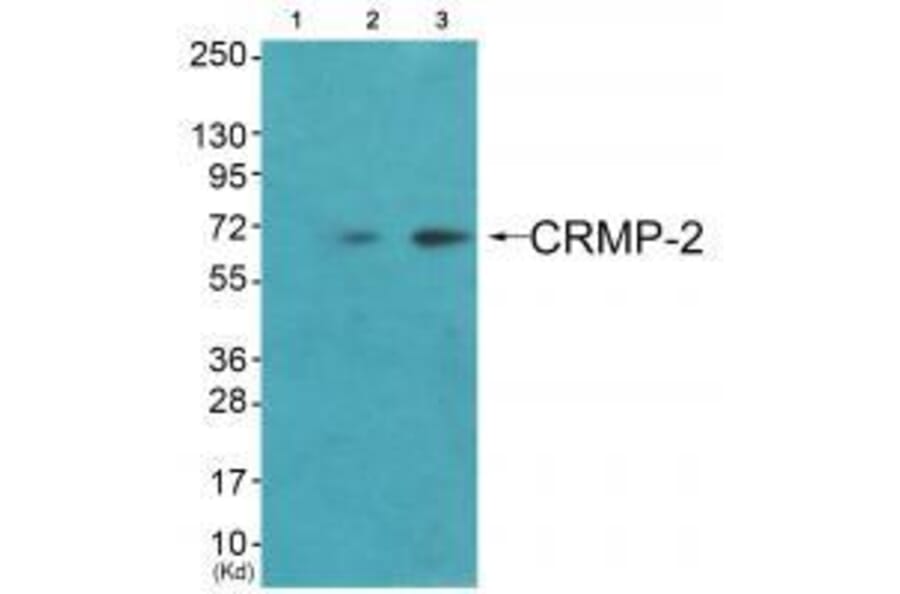 Western blot - CRMP-2 (Ab-522) Antibody from Signalway Antibody (33317) - Antibodies.com