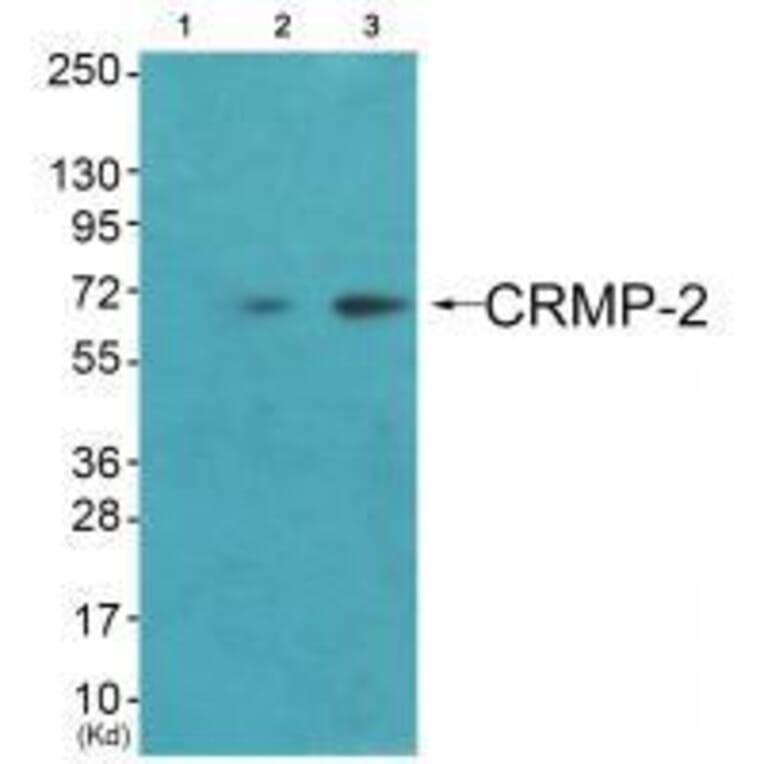 Western blot - CRMP-2 (Ab-522) Antibody from Signalway Antibody (33317) - Antibodies.com