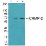Western blot - CRMP-2 (Ab-522) Antibody from Signalway Antibody (33317) - Antibodies.com