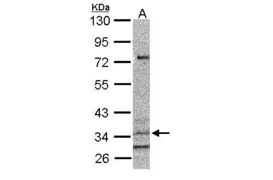CysLT1 Receptor Antibody from Signalway Antibody (35340) - Antibodies.com