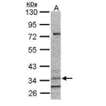 CysLT1 Receptor Antibody from Signalway Antibody (35340) - Antibodies.com