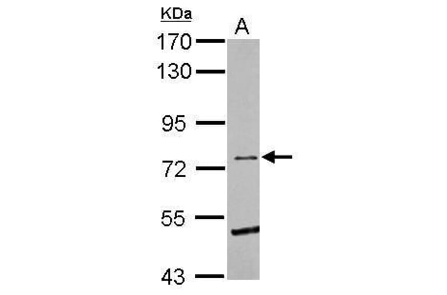 Eph Receptor B6 Antibody from Signalway Antibody (35492) - Antibodies.com