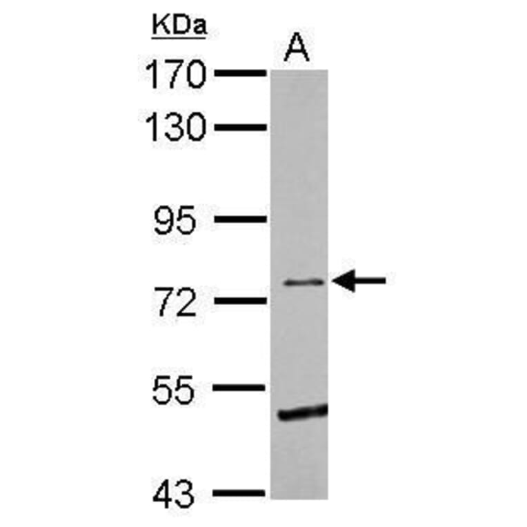 Eph Receptor B6 Antibody from Signalway Antibody (35492) - Antibodies.com