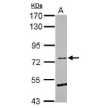 Eph Receptor B6 Antibody from Signalway Antibody (35492) - Antibodies.com