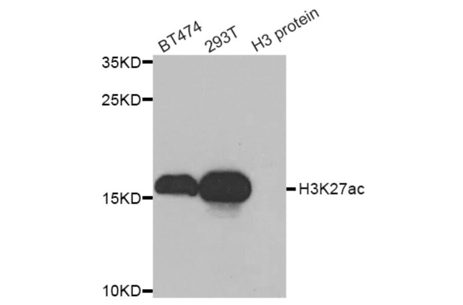 Western blot - Histone H3K27AC antibody from Signalway Antibody (39193) - Antibodies.com