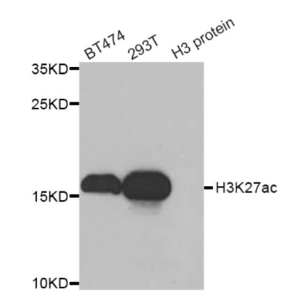 Western blot - Histone H3K27AC antibody from Signalway Antibody (39193) - Antibodies.com