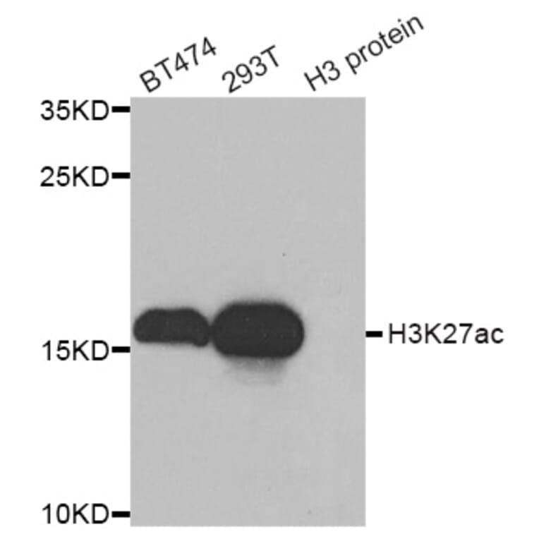 Western blot - Histone H3K27AC antibody from Signalway Antibody (39193) - Antibodies.com