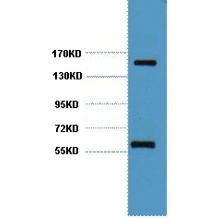 Western blot - CD45 Monoclonal Antibody from Signalway Antibody (40420) - Antibodies.com