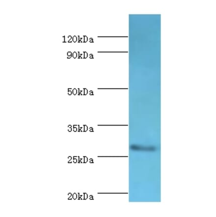 CD48 Polyclonal Antibody from Signalway Antibody (42109) - Antibodies.com