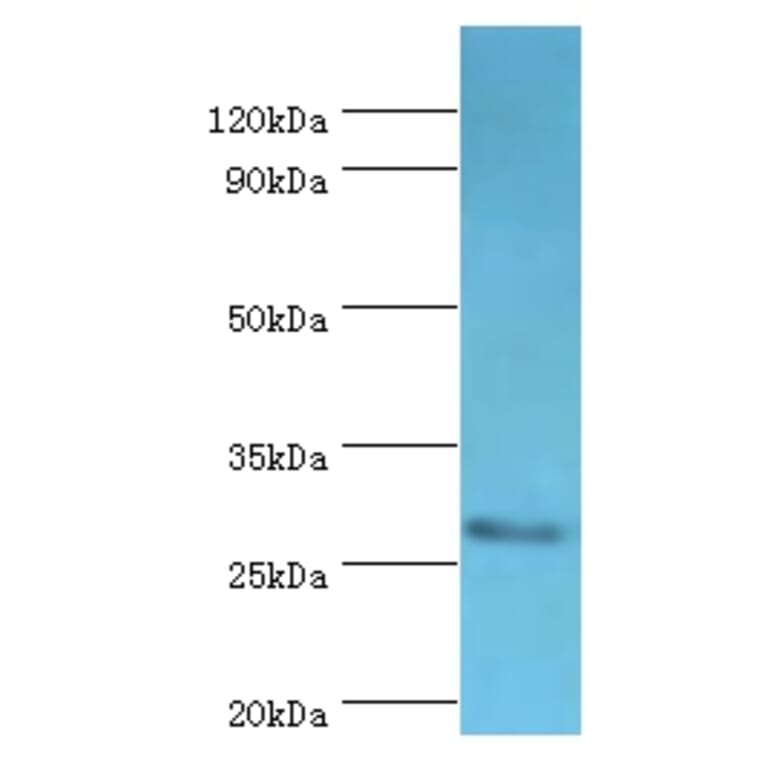 CD48 Polyclonal Antibody from Signalway Antibody (42109) - Antibodies.com