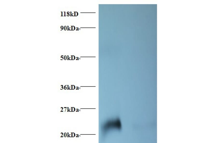 NGAL Polyclonal Antibody from Signalway Antibody (42467) - Antibodies.com