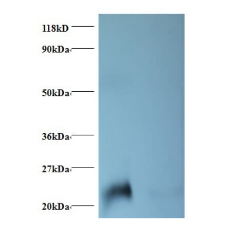 NGAL Polyclonal Antibody from Signalway Antibody (42467) - Antibodies.com