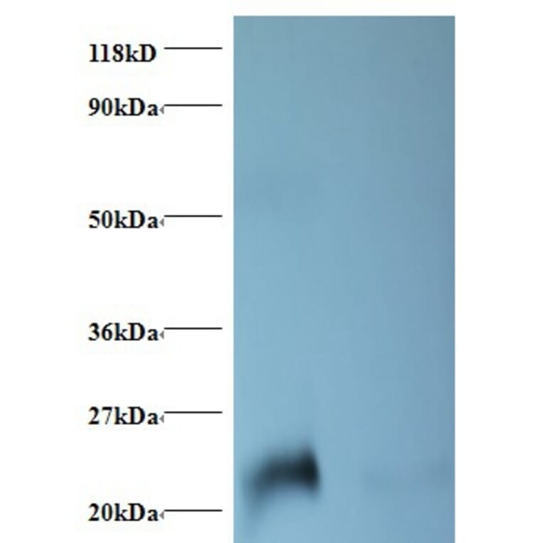 NGAL Polyclonal Antibody from Signalway Antibody (42467) - Antibodies.com
