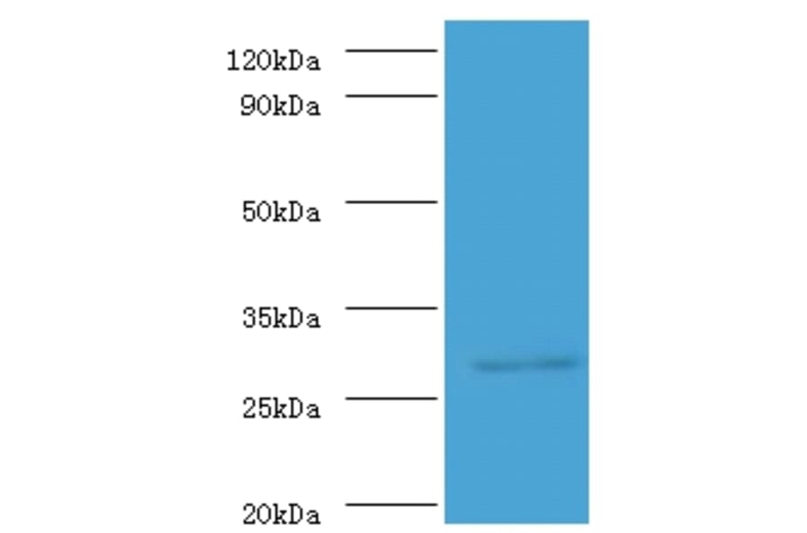 ureA Polyclonal Antibody from Signalway Antibody (42580) - Antibodies.com
