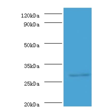 ureA Polyclonal Antibody from Signalway Antibody (42580) - Antibodies.com