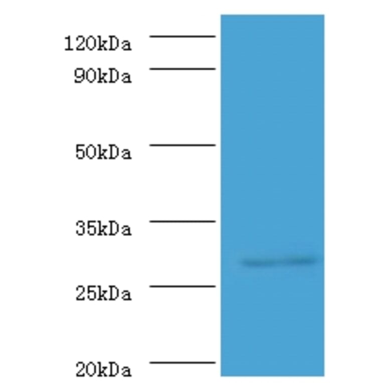 ureA Polyclonal Antibody from Signalway Antibody (42580) - Antibodies.com