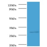 ureA Polyclonal Antibody from Signalway Antibody (42580) - Antibodies.com