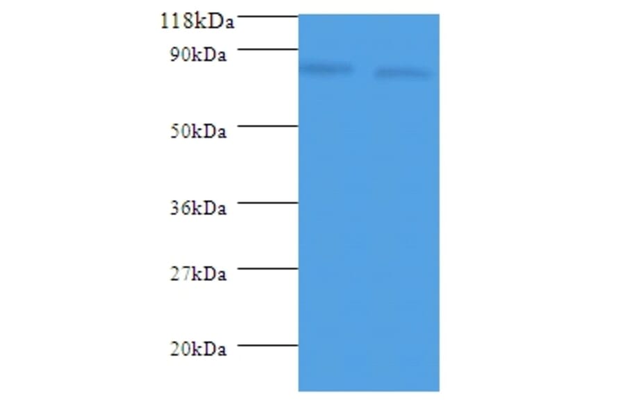 ldcC Polyclonal Antibody from Signalway Antibody (42603) - Antibodies.com