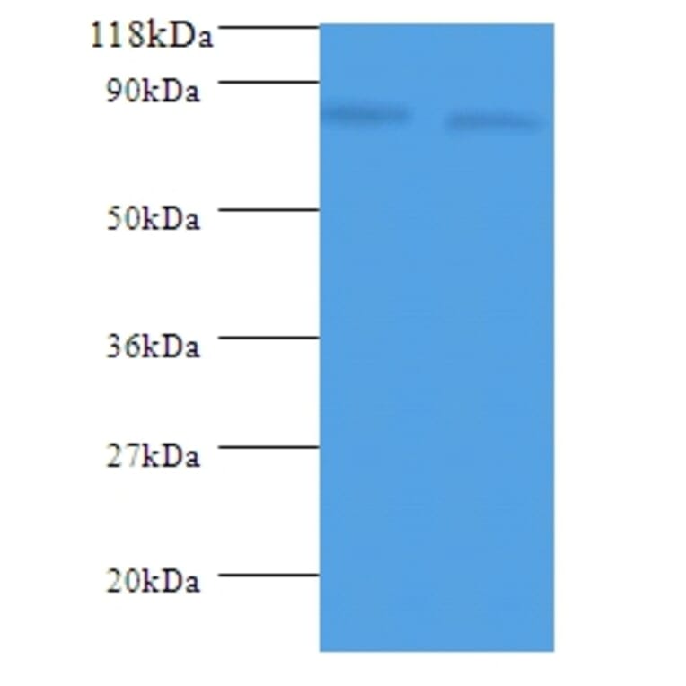 ldcC Polyclonal Antibody from Signalway Antibody (42603) - Antibodies.com