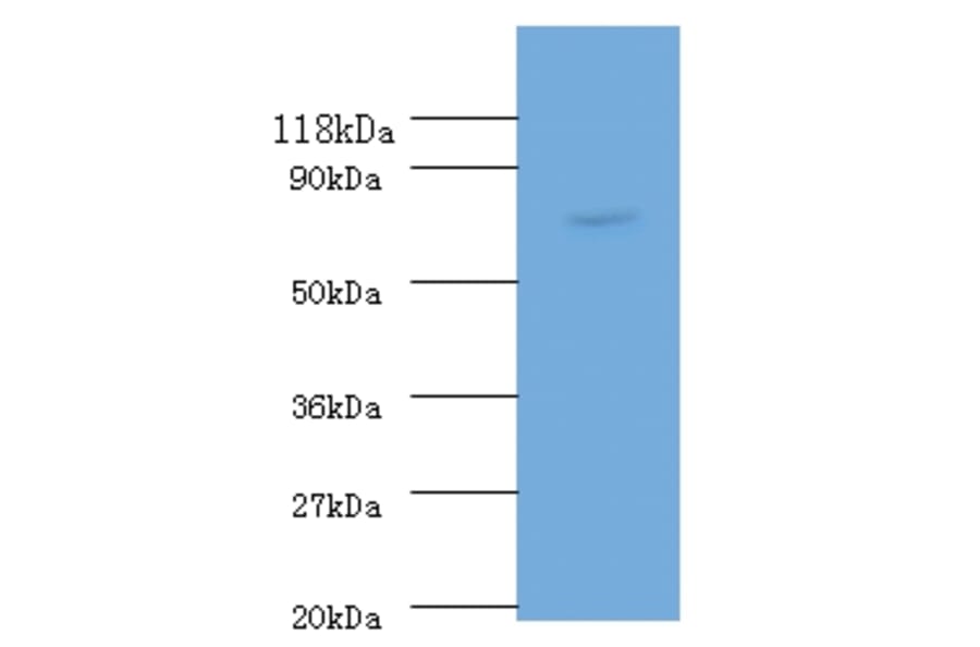 RecQ Polyclonal Antibody from Signalway Antibody (42617) - Antibodies.com