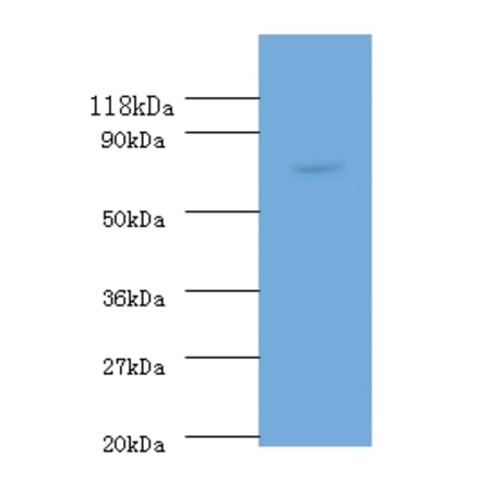 RecQ Polyclonal Antibody from Signalway Antibody (42617) - Antibodies.com