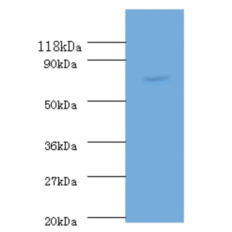 RecQ Polyclonal Antibody from Signalway Antibody (42617) - Antibodies.com