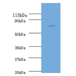 RecQ Polyclonal Antibody from Signalway Antibody (42617) - Antibodies.com