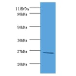 DeoD Polyclonal Antibody from Signalway Antibody (42622) - Antibodies.com