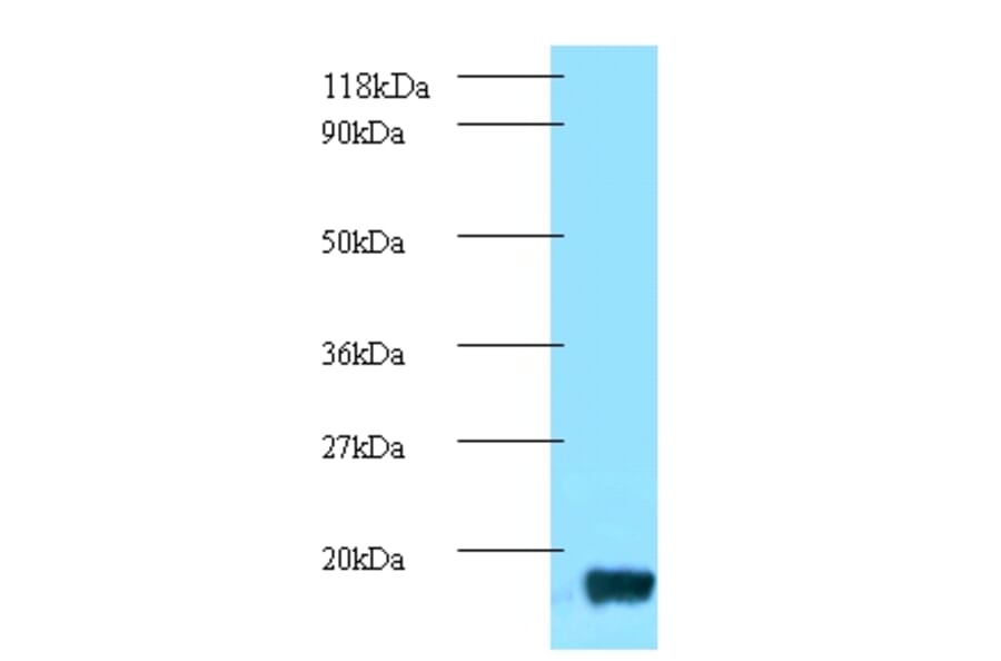 trxA Polyclonal Antibody from Signalway Antibody (42624) - Antibodies.com