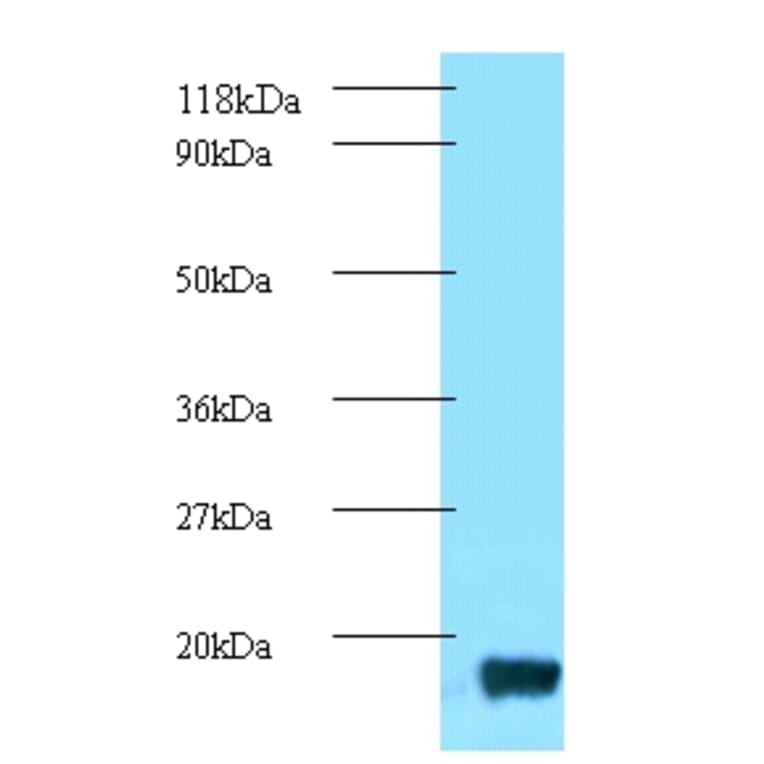 trxA Polyclonal Antibody from Signalway Antibody (42624) - Antibodies.com