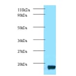trxA Polyclonal Antibody from Signalway Antibody (42624) - Antibodies.com