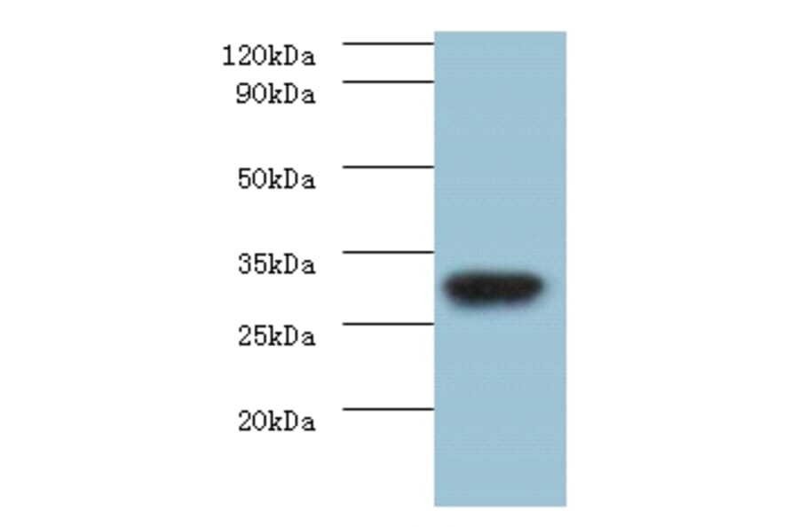 rbsK Polyclonal Antibody from Signalway Antibody (42625) - Antibodies.com