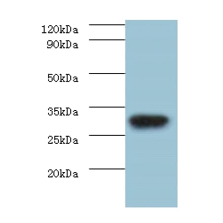 rbsK Polyclonal Antibody from Signalway Antibody (42625) - Antibodies.com