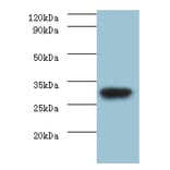 rbsK Polyclonal Antibody from Signalway Antibody (42625) - Antibodies.com