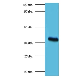 ptxA Polyclonal Antibody from Signalway Antibody (42634) - Antibodies.com