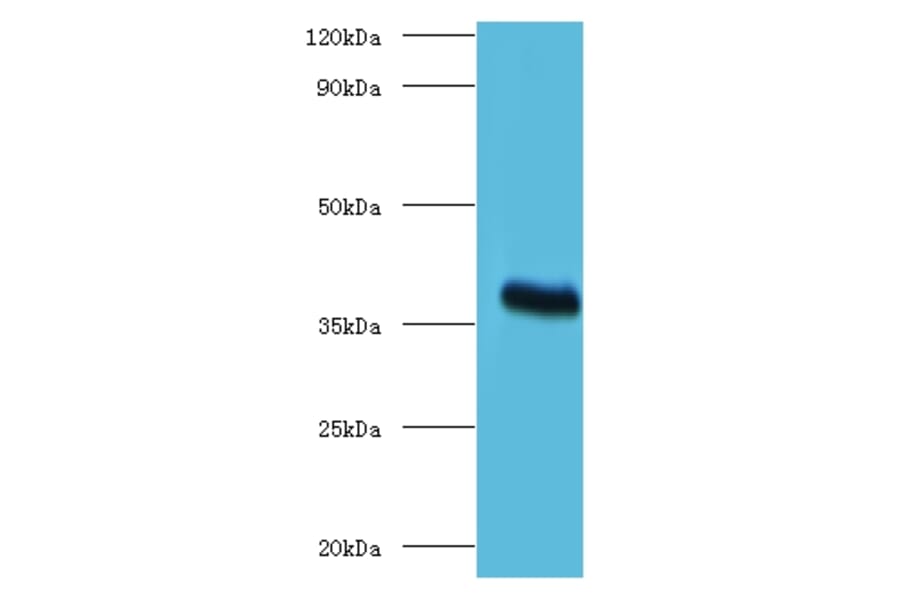 ptxA Polyclonal Antibody from Signalway Antibody (42634) - Antibodies.com
