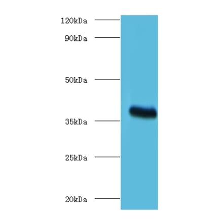 ptxA Polyclonal Antibody from Signalway Antibody (42634) - Antibodies.com