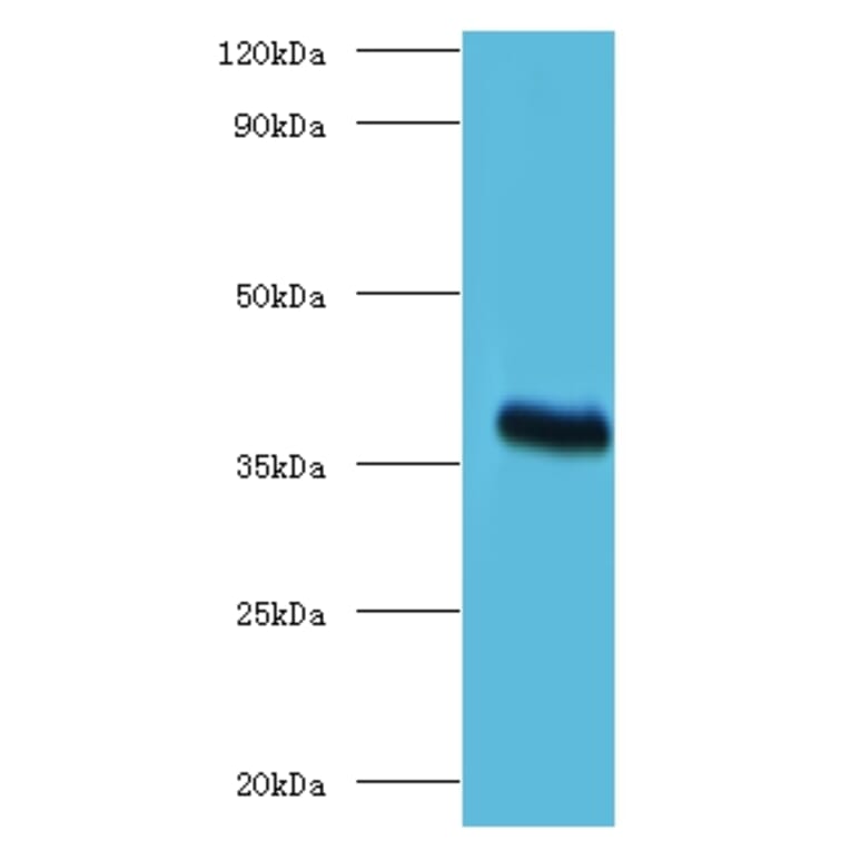 ptxA Polyclonal Antibody from Signalway Antibody (42634) - Antibodies.com