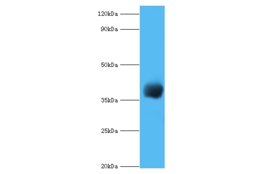 cpg2 Polyclonal Antibody from Signalway Antibody (42637) - Antibodies.com