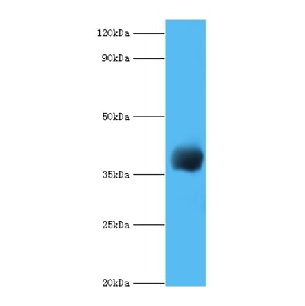 cpg2 Polyclonal Antibody from Signalway Antibody (42637) - Antibodies.com