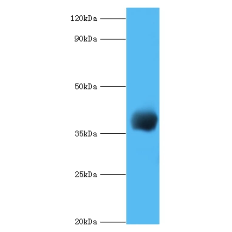 cpg2 Polyclonal Antibody from Signalway Antibody (42637) - Antibodies.com